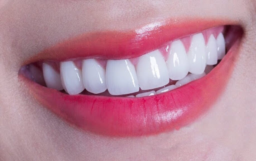 CÁCH CHỌN DÁNG RĂNG SỨ PHÙ HỢP VỚI KHUÔN MẶT CHUẨN TỶ LỆ VÀNG 2 Cách chọn dáng răng sứ phù hợp với khuôn mặt