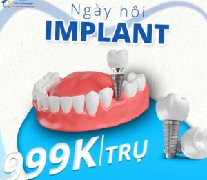 Tại sao nên cấy ghép implant?