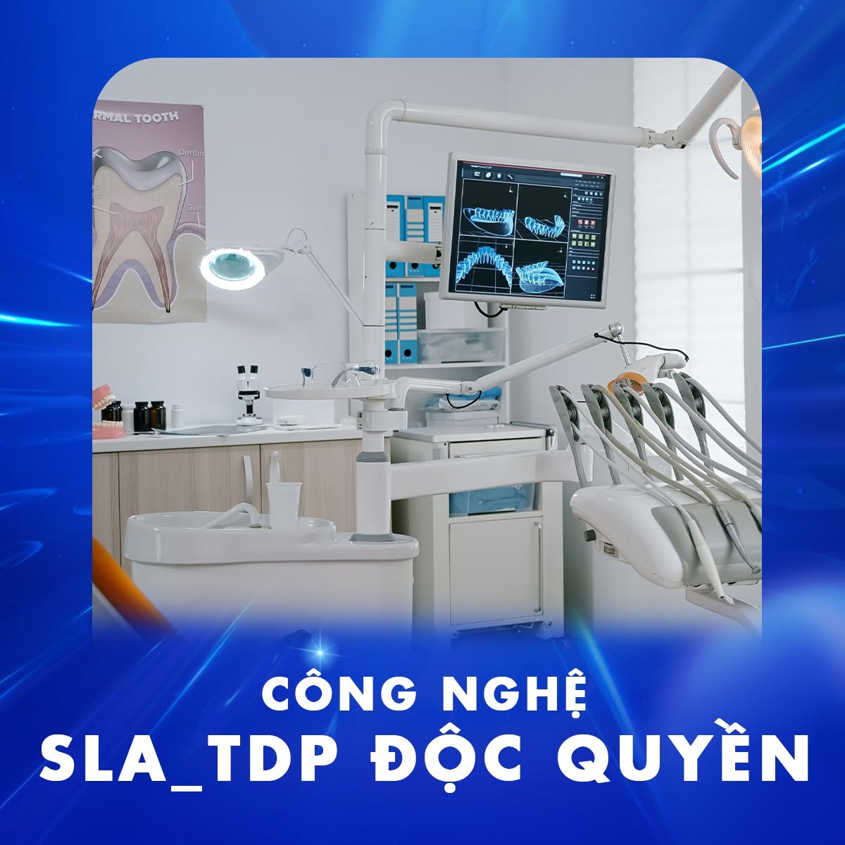 Cấy Ghép Implant Uy Tín Bắc Ninh 2026 Ở Đâu? Bản Tin Nha Khoa Tâm Đức Phát 2 cay-ghep-implant-uy-tin-bac-ninh-2