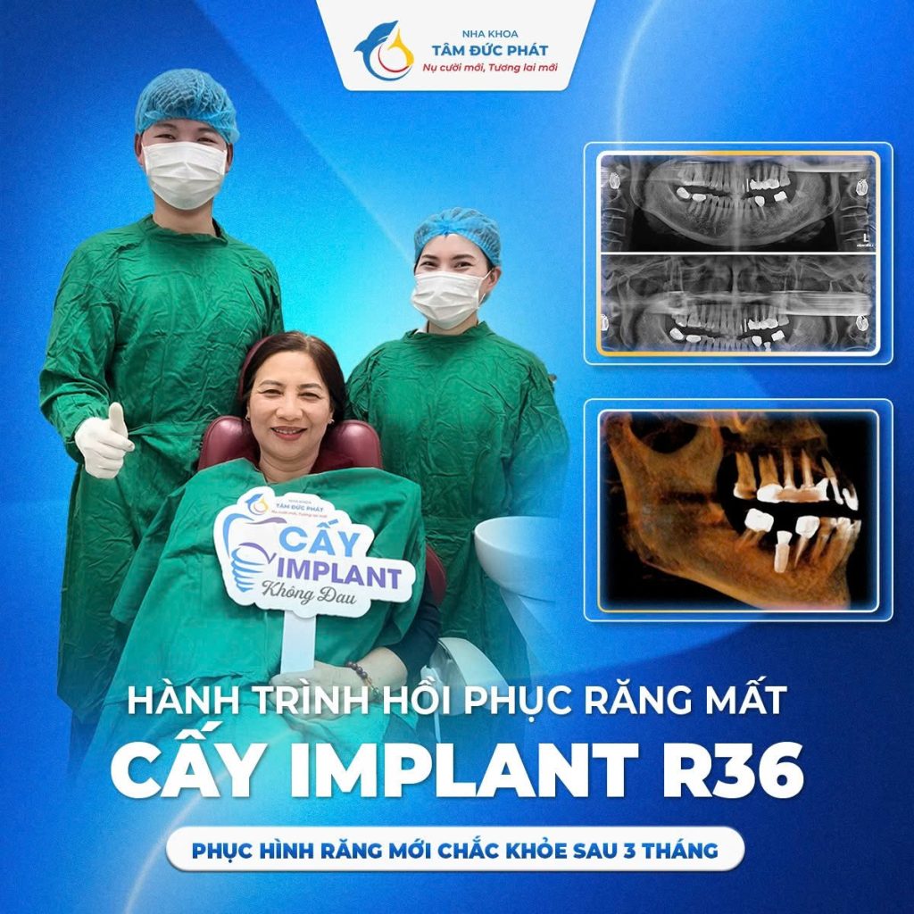 Địa Chỉ Trồng Răng Implant Tại Bắc Ninh Uy Tín – Nha Khoa Tâm Đức Phát 2 dia chi trong rang implant tai bac ninh 2