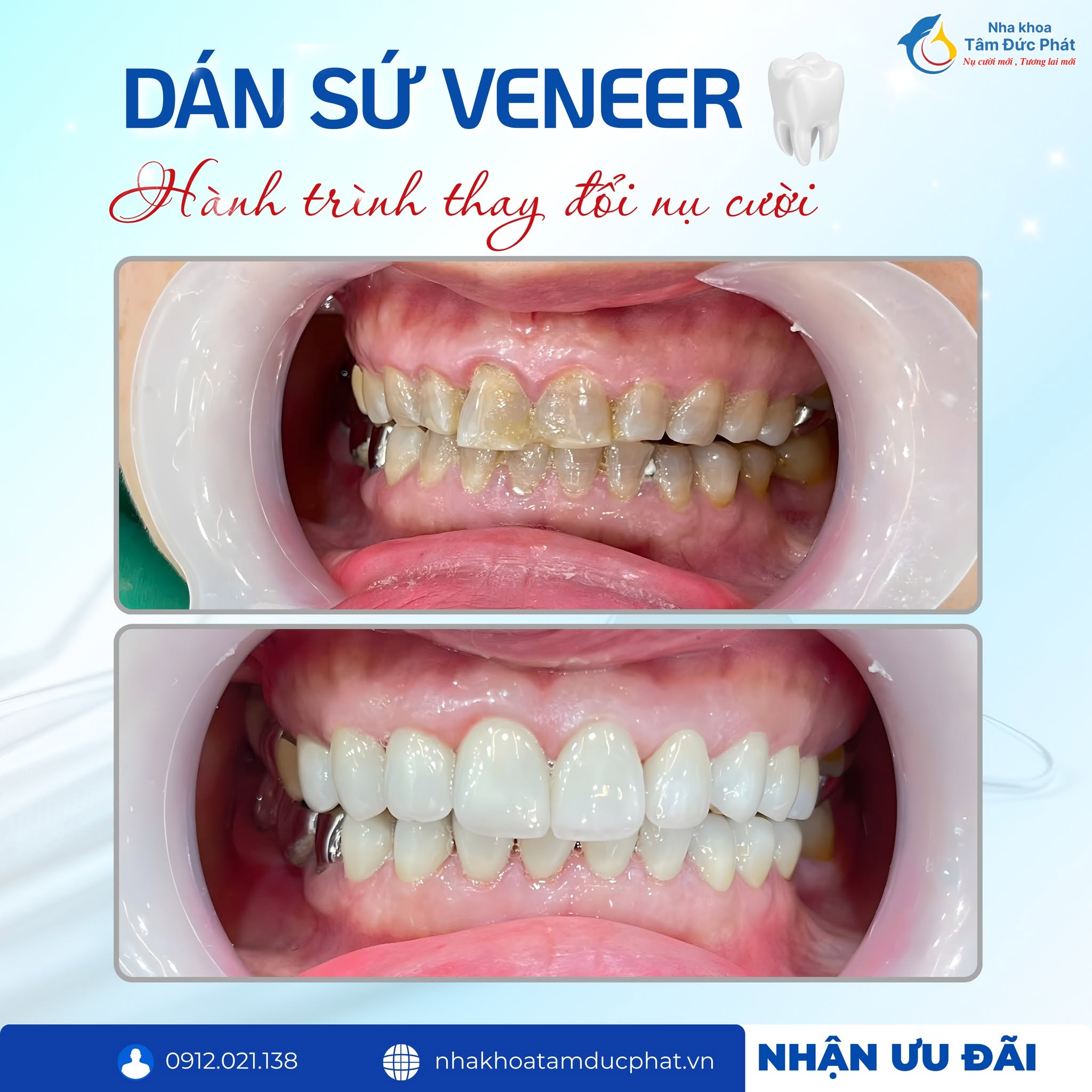 Mức giá luôn đi kèm chất lượng tại Nha khoa Tâm Đức Phát