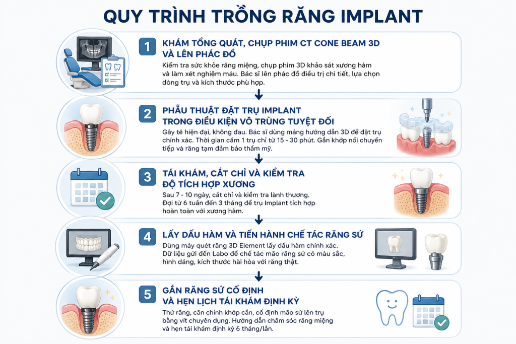 QUY TRÌNH CẤY GHÉP RĂNG IMPLANT CHUẨN Y KHOA TẠI TÂM ĐỨC PHÁT 1 Quy trình cấy ghép răng implant chuẩn y khoa tại Tâm Đức Phát