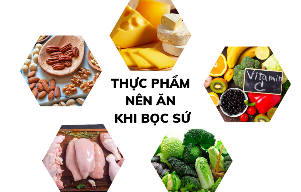 CÁCH CHĂM SÓC RĂNG SAU KHI DÁN SỨ VENEER SIÊU MỎNG CHUẨN Y KHOA 2 Thực phẩm nền ăn sau khi làm răng sứ