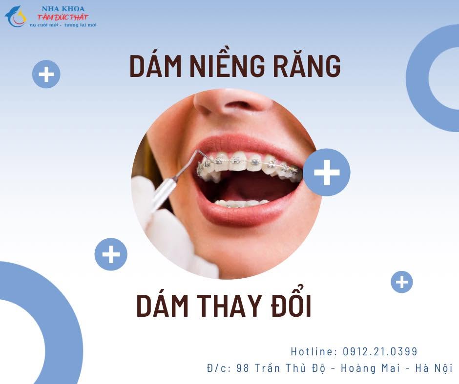 Dám niềng răng, dám thay đổi
