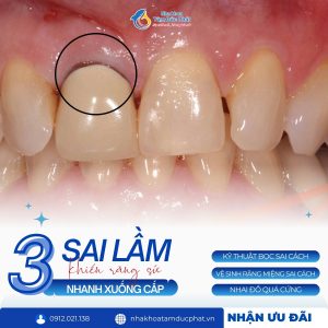 Tác hại của việc bọc răng sứ giá rẻ tại cơ sở chui